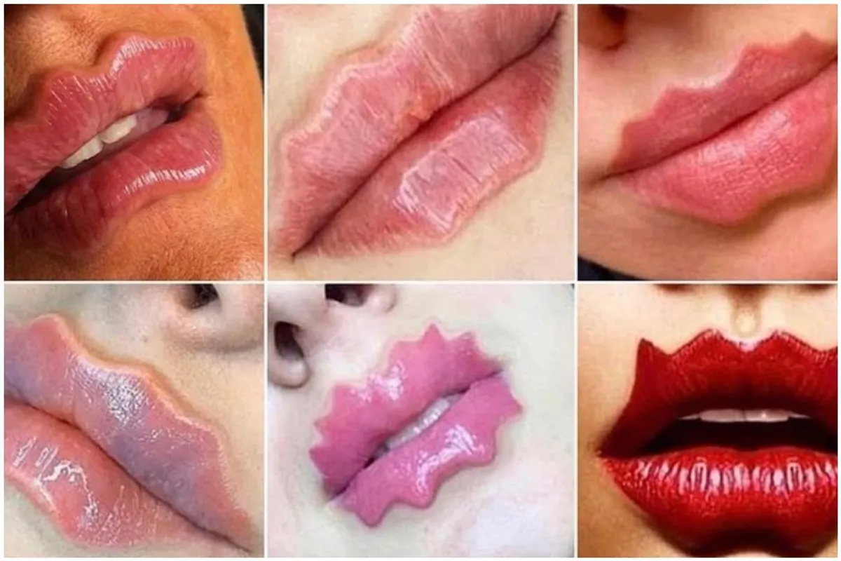 'Vražje usne': Novi bizaran trend u industriji ljepote