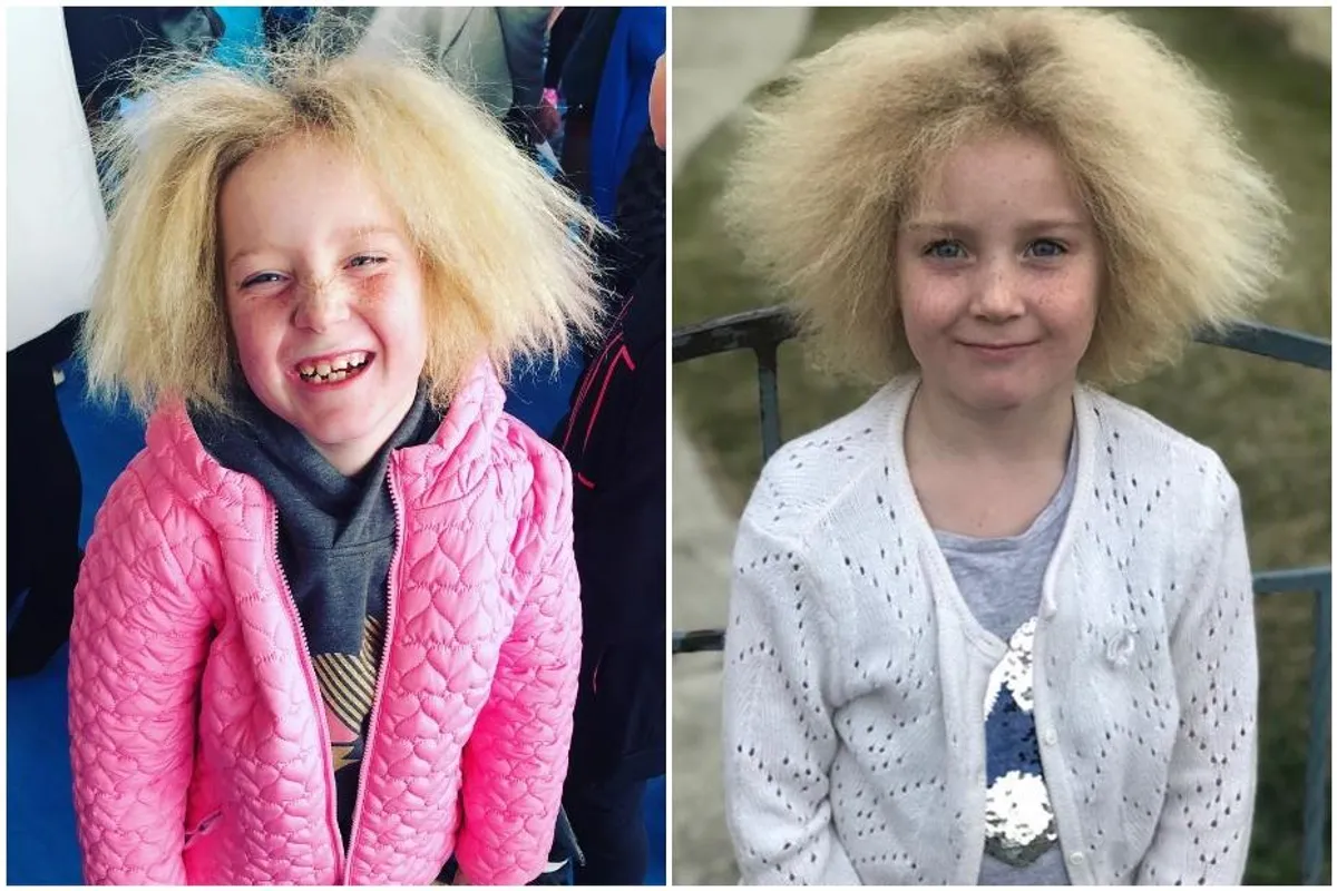 Djevojčica sa 'sindromom nečešljive kose' svoju jedinstvenost nosi sa stilom