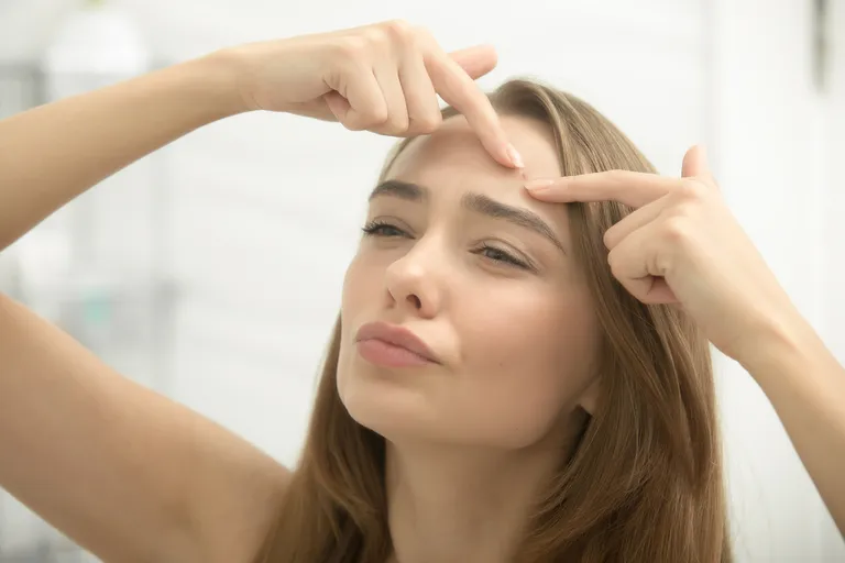 1. Čelo i rub kose - Razlog pojave često su kozmetički proizvodi koji loše reagiraju s vašom kožom. Također, razlozi mogu biti probavne prirode - nezdrava prehrana koja vodi do probavne neravnoteže