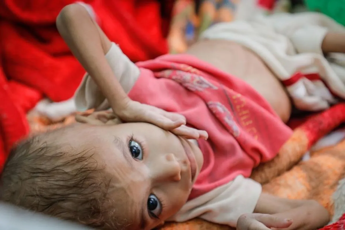 Pomozite djeci Jemena da prežive