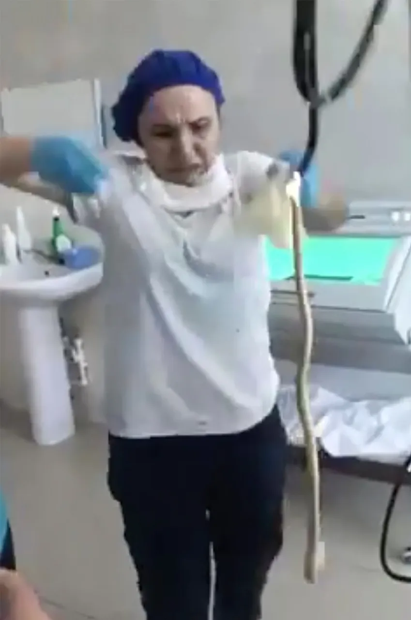 Shocking video shows medics pull 4ft snake from young woman's mouth after the reptile slithered down her throat as she slept in the yard of her house