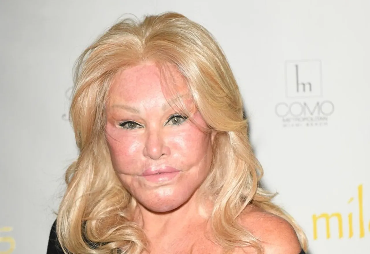 jocelyn wildenstein