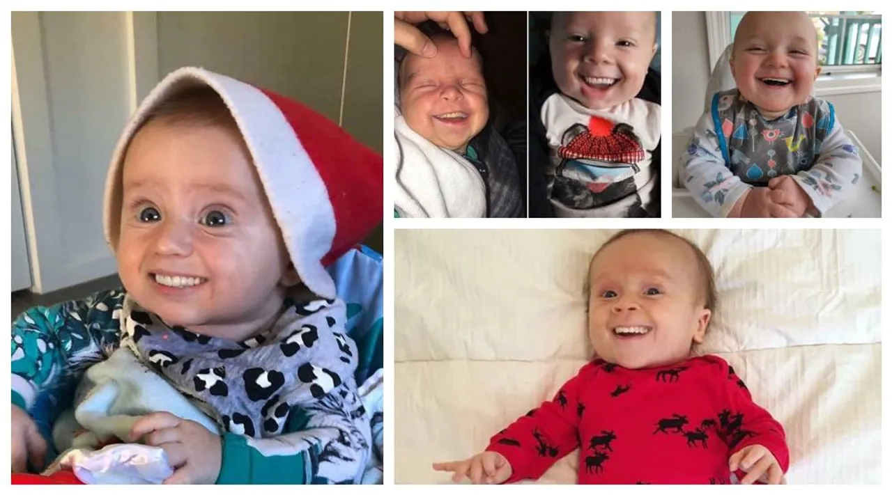 Ove slike beba s zubima odraslih ljudi izgledaju poprilično uznemirujuće