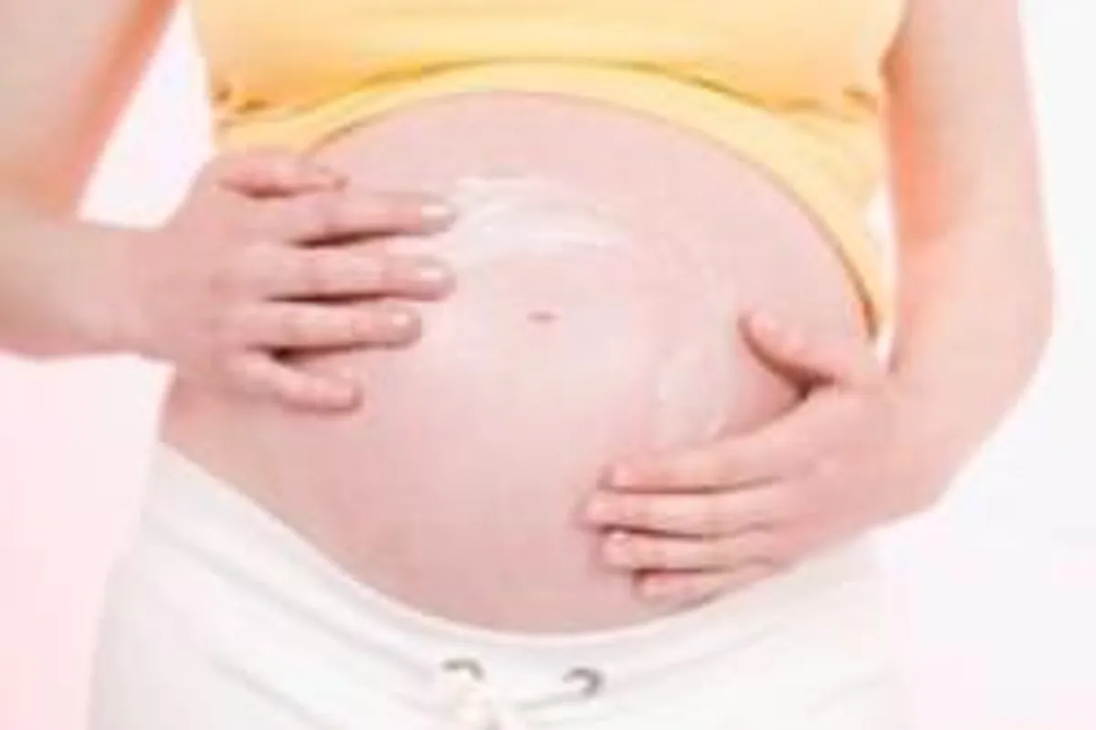 Strije u trudnoći