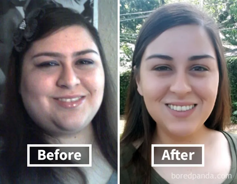 before-after-weight-loss-face-transformation-2-59ef3f323d68d__700