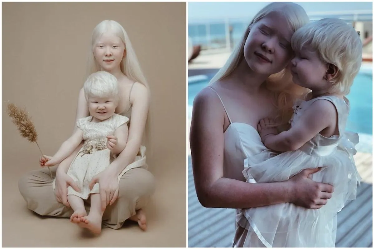 Iako je između njih 12 godina razlike, ove albino sestre raznježile su svijet svojom ljepotom