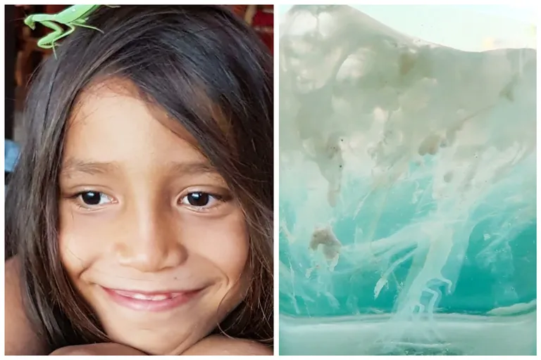 Dječak (9) preminuo nakon uboda meduze