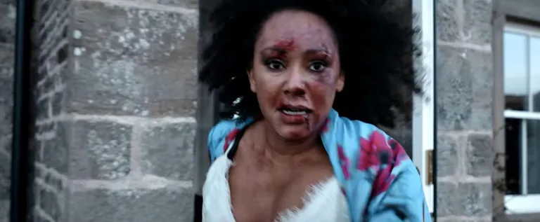 A beaten and bruised Mel B appears in shocking domestic violence video to highlight abuse