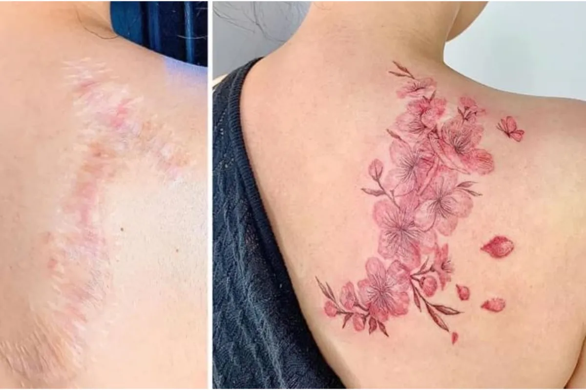 ožiljak tetovaža.jpg