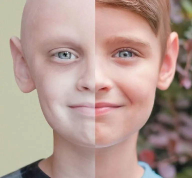 Prije i nakon izliječenja raka. Slobodno zaplačite.